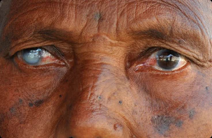 A 300-Year-Old Riddle Was Finally Answered. The Answer Was Disturbing.