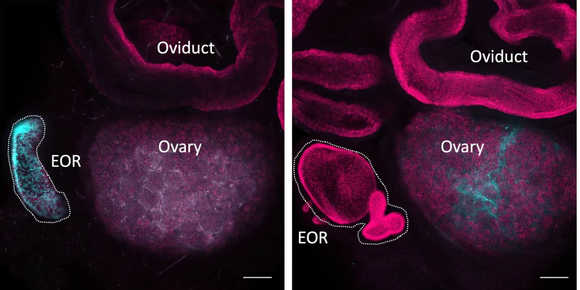 Rete Ovarii: The 'New Organ' That's Been Known Since 1870